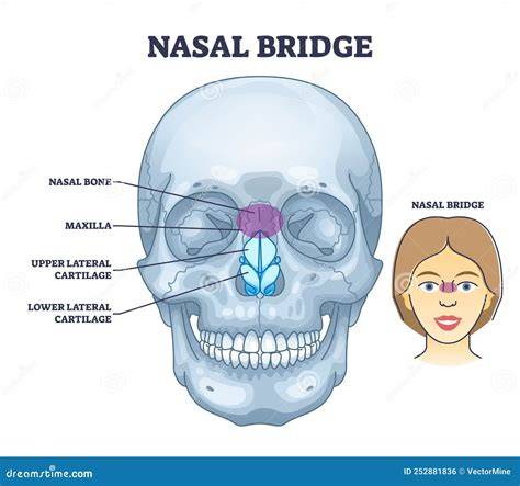 Schema anatomico del naso con evidenziazione delle aree anteriori e posteriori dove possono verificarsi epistassi.