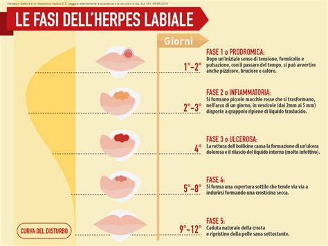 Le cinque fasi dell'herpes labiale