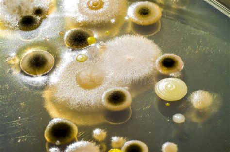 Microscopio con mostra di batteri e funghi