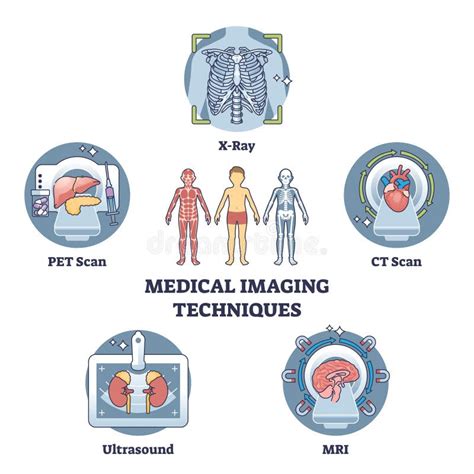 Diagramma che illustra le diverse tecniche di imaging medico