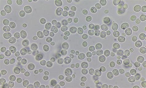 Microrganismi del lievito al microscopio