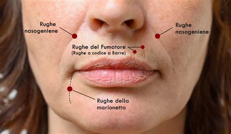 Immagine di una persona che fuma con rughe marcate intorno alla bocca