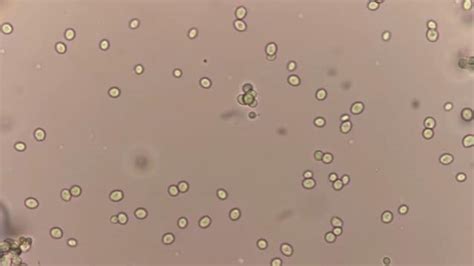 Microscopio che osserva particelle di lievito in sospensione nel vino