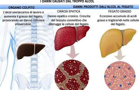 diagramma degli effetti dell'alcol sul fegato