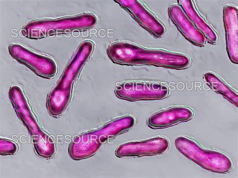 Batterio Clostridium botulinum al microscopio elettronico