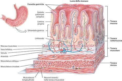 Diagramma dello stomaco con evidenziata la mucosa e la lesione ulcerosa