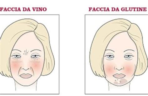 Infografica che illustra gli effetti negativi dell'alcol sulla pelle: disidratazione, invecchiamento precoce, rossori, acne.