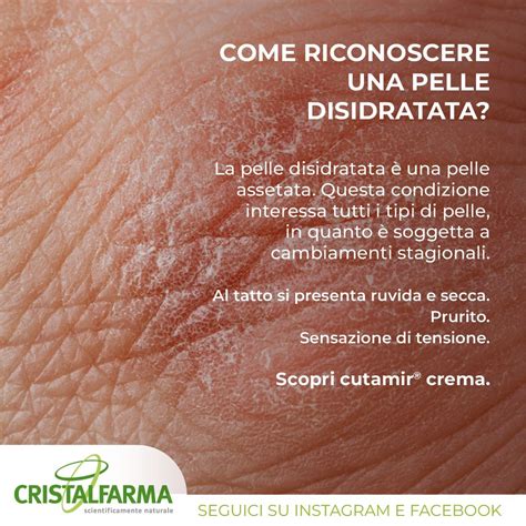 Schema di una routine di skincare per pelle disidratata, con i passaggi: detersione, tonico, siero, crema giorno/notte, protezione solare.